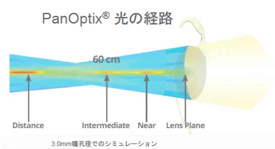 PanOptix 光の経路