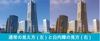 通常の見え方と白内障の見え方の例