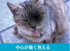 加齢黄斑変性で中心が暗く見える状態