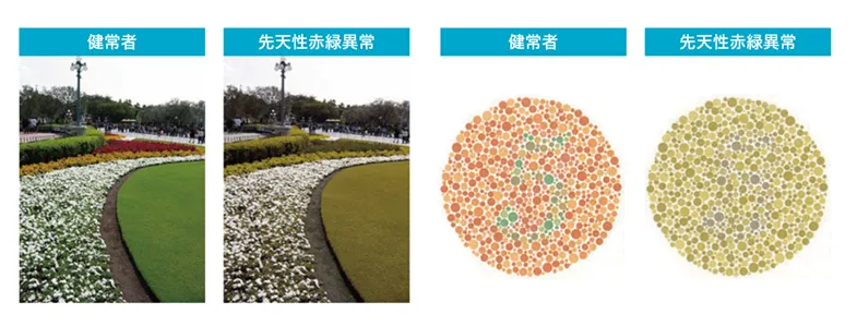 健常者と先天性色覚異常の見え方の違い