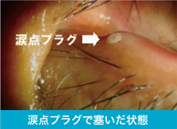 医師の診察を受ける時期