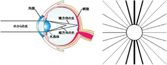 乱視の場合