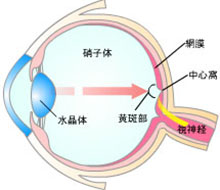 加齢黄斑変性