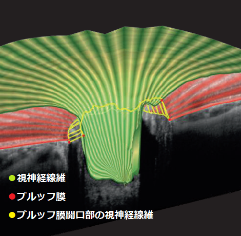 網膜の断層像