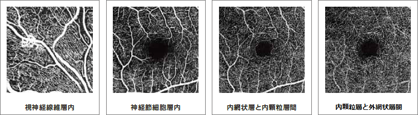 OCT-ANGIOGRAPHY